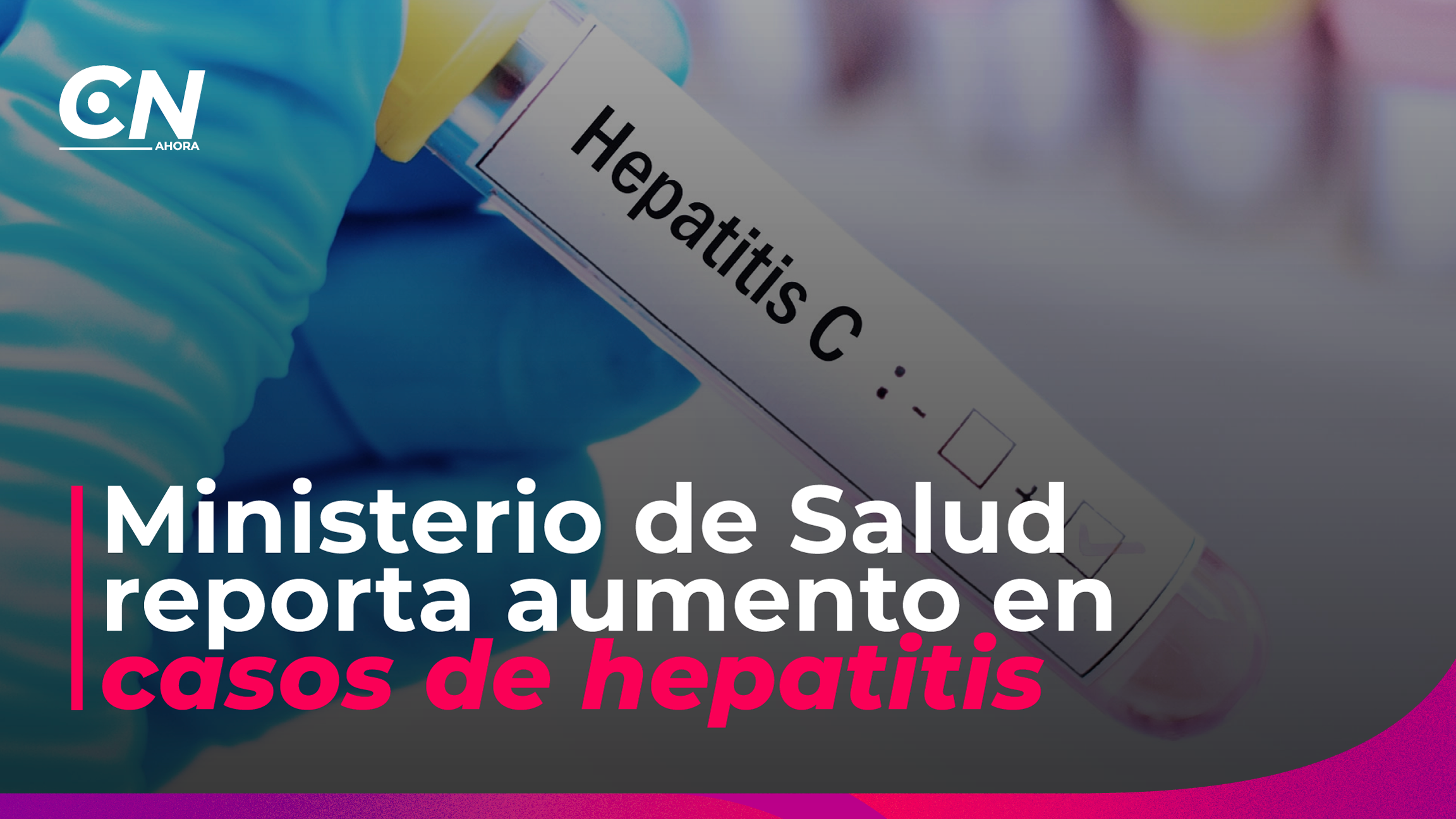 Costa Rica registra 772 casos de hepatitis A en 2026.